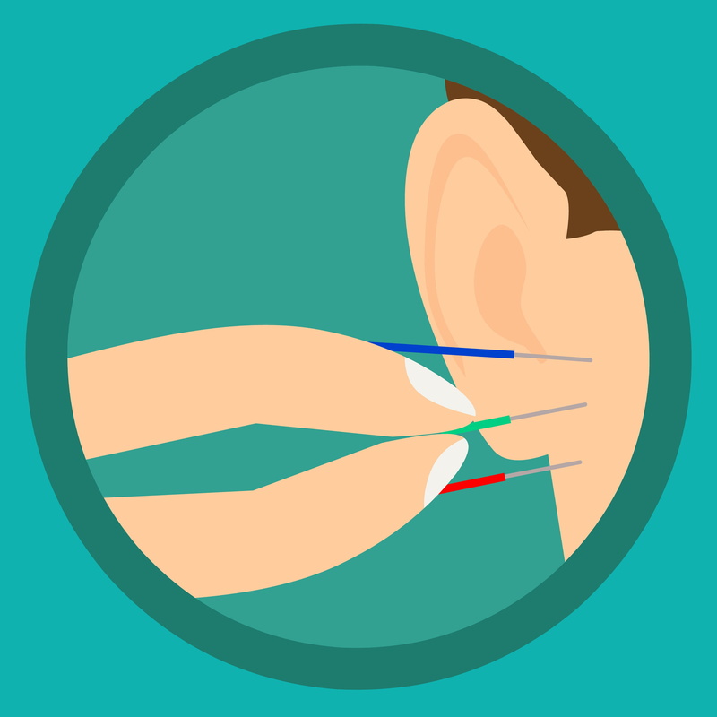 lifestyle, illustration, 1080P, close-up, acupuncturist, health, sensory, body, healthy, acupuncture, anatomy, treatment, puncture, ear, nature, blue