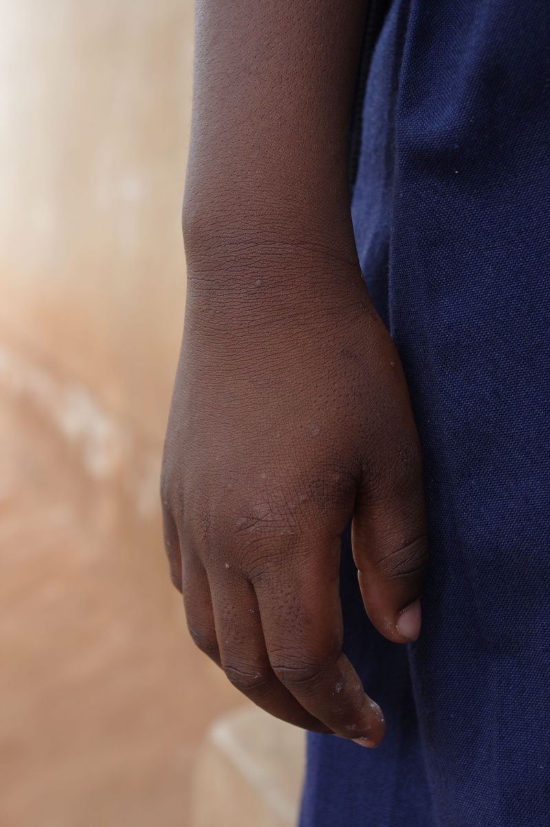 charity, one person, help, tanzania, travel, protection, voluntary, finger, indoors, continent, casual clothing, standing, volunteer, body part, ethnic
