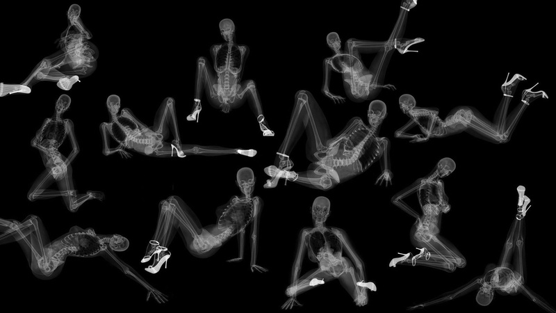 black background, healthcare And Medicine, indoors, motion, people, whole, blue, multiple image, no people, x, x-ray, backgrounds, isolated, black Color
