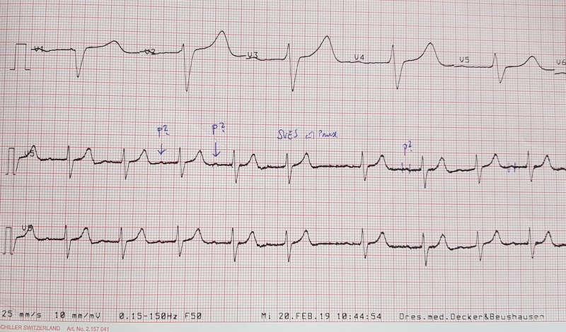 heart, ecg, western script, doctors office, instrument of measurement, close-up, document, pattern, text, message, 2K, communication, healthcare and medicine