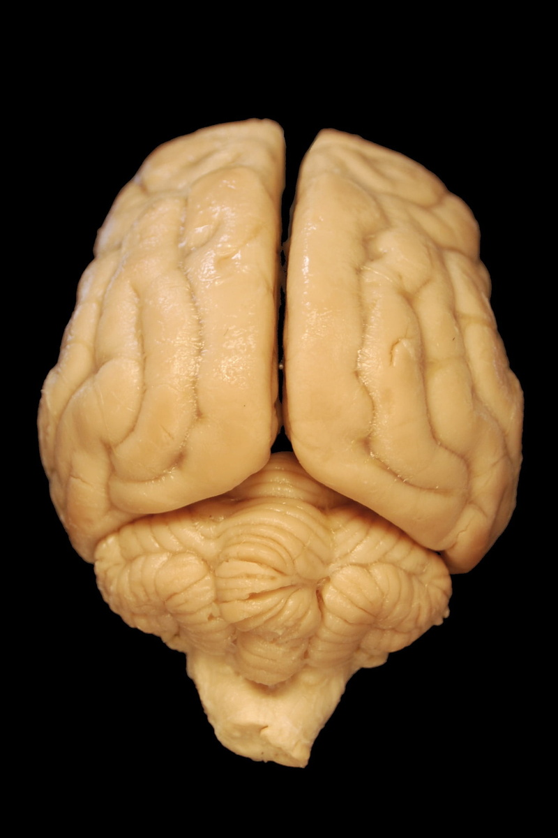 surface, human Brain, Dog, single object, human body part, black, human finger, finger, indoors, veterinary medicine, cerebrum, studio shot, model, cerebellum