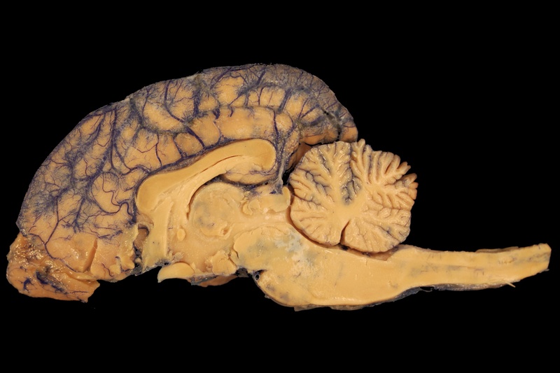 single object, veins, 2K, archaeology, brain, marine, horse, biology, grey matter, no people, pattern, cerebellum, paleontology, animal, bar, veterinary medicine