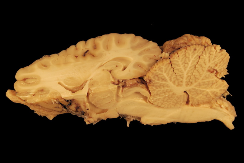 black background, black color, studio shot, rose, cerebrum, science, cut out, anatomy, still life, cerebellum, fragility, close-up, Horse, white matter