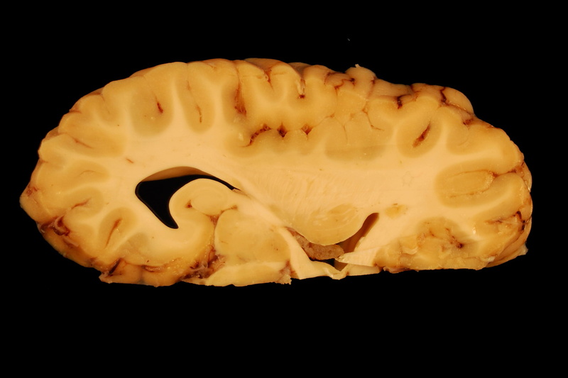 unhealthy eating, grey matter, sweet, snack, food and drink, eyes, ventricle, paerparat, anatomy, biology, baked, still life, veterinary medicine, close-up