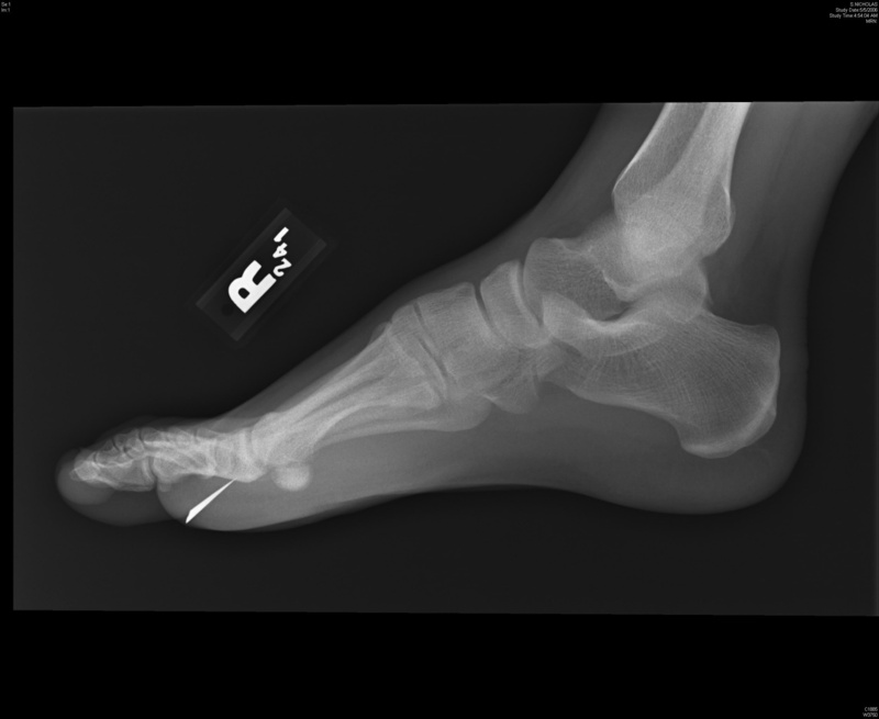 feet, x, art, people, hd, Xray, 1080P