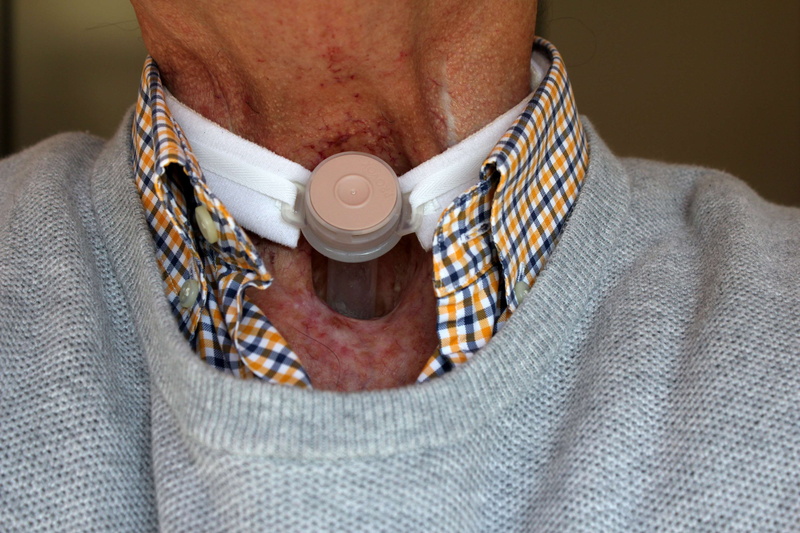 men, disability, midsection, tracheotom, human neck, mature adult, esophagus, surgical, adult, casual clothing, operation procedure, tracheostomy, laryngectomy