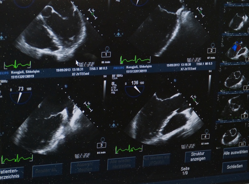 diagram, medical, equipment, ct, music, health check, x ray image, result, technology, text, audio equipment, night, arts culture and entertainment, scan