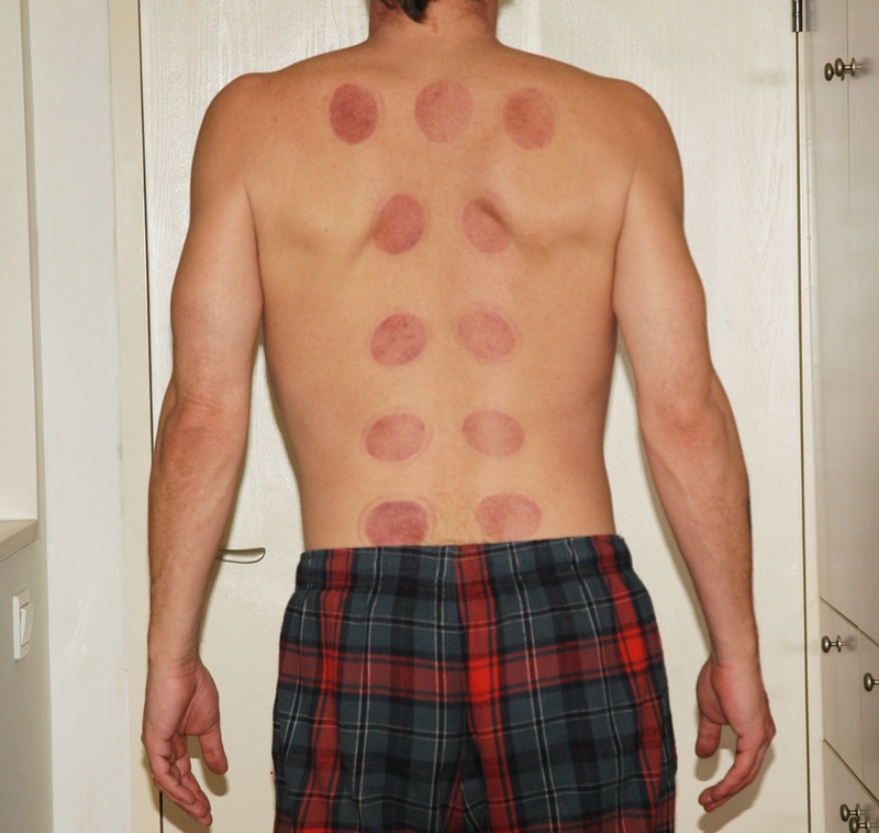 showing, real people, person, midsection, traditional, patient, lifestyles, domestic bathroom, chinese, shirtless, rear view, standing, marks, human body part