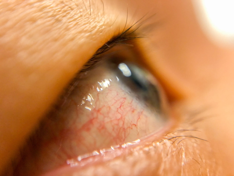 human face, eyes, human body part, beautiful woman, healthcare and medicine, eyeball, iris - eye, human eye, 4K, extreme close-up, eyelash, ntu hospital station