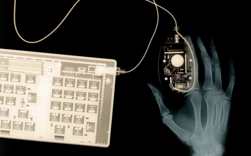 Mouse, computer, technology, X-ray, data, healthcare and medicine, computer equipment, keyboard, communication, people, 1080P, black background, human body part