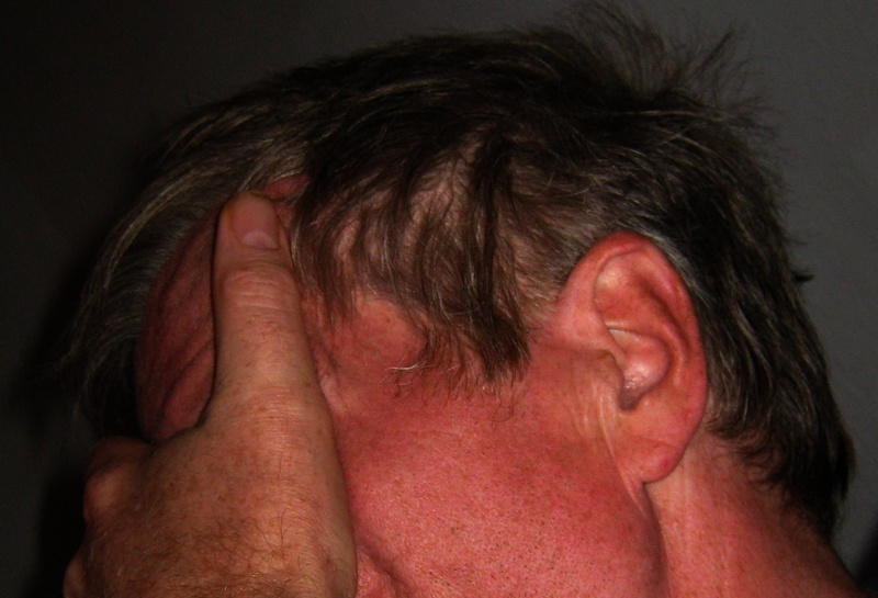 burnout, human hair, indoors, physical injury, portrait, nerves, studio shot, head, human body part, senior Adult, hand over eyes, hopelessness, severe head