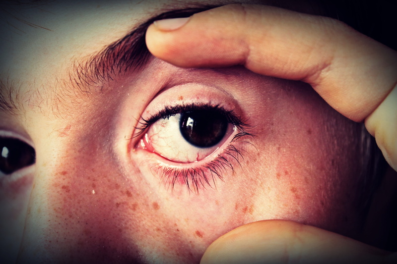 eyeball, bruise, Eyebrow, Child, looking at camera, emotion, 4K, young men, eyelash, one man only, body part, men, aggression, adult, real people, human eye