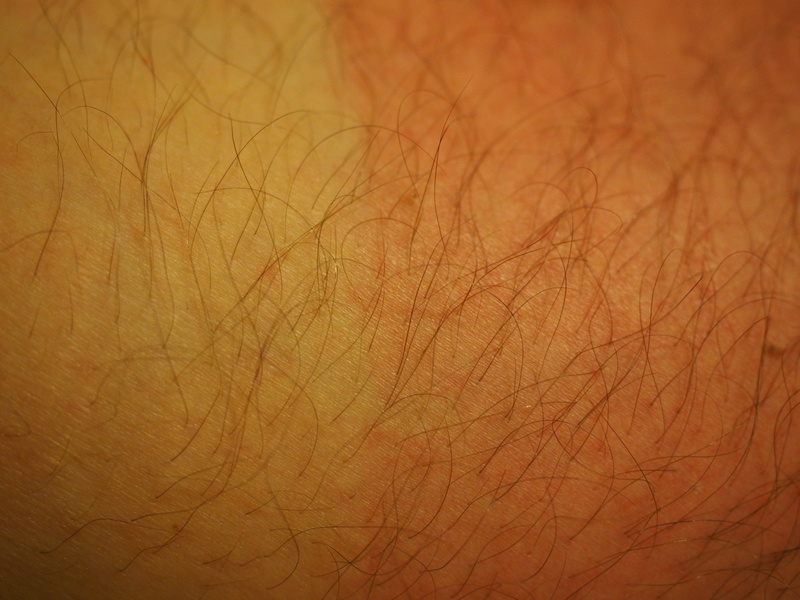 tree, backgrounds, textured effect, selective focus, skin irritation, burned, human skin, 4K, hair, human body part, red, man, bare tree, risk, sun, branch