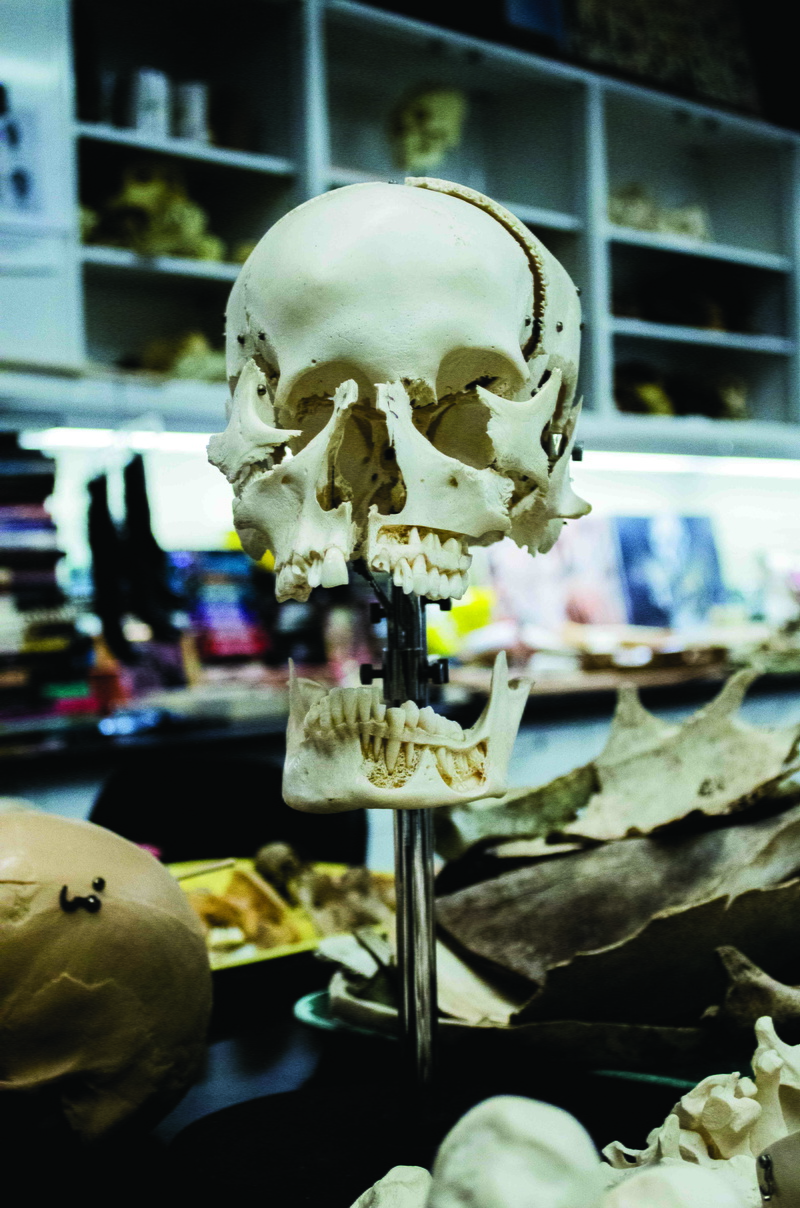 white, sweet food, skull, human skeleton, forensic, teeth, indoors, still life, lab, human, creativity, exploded skull, 5K, dead, stand, death, bone, no people