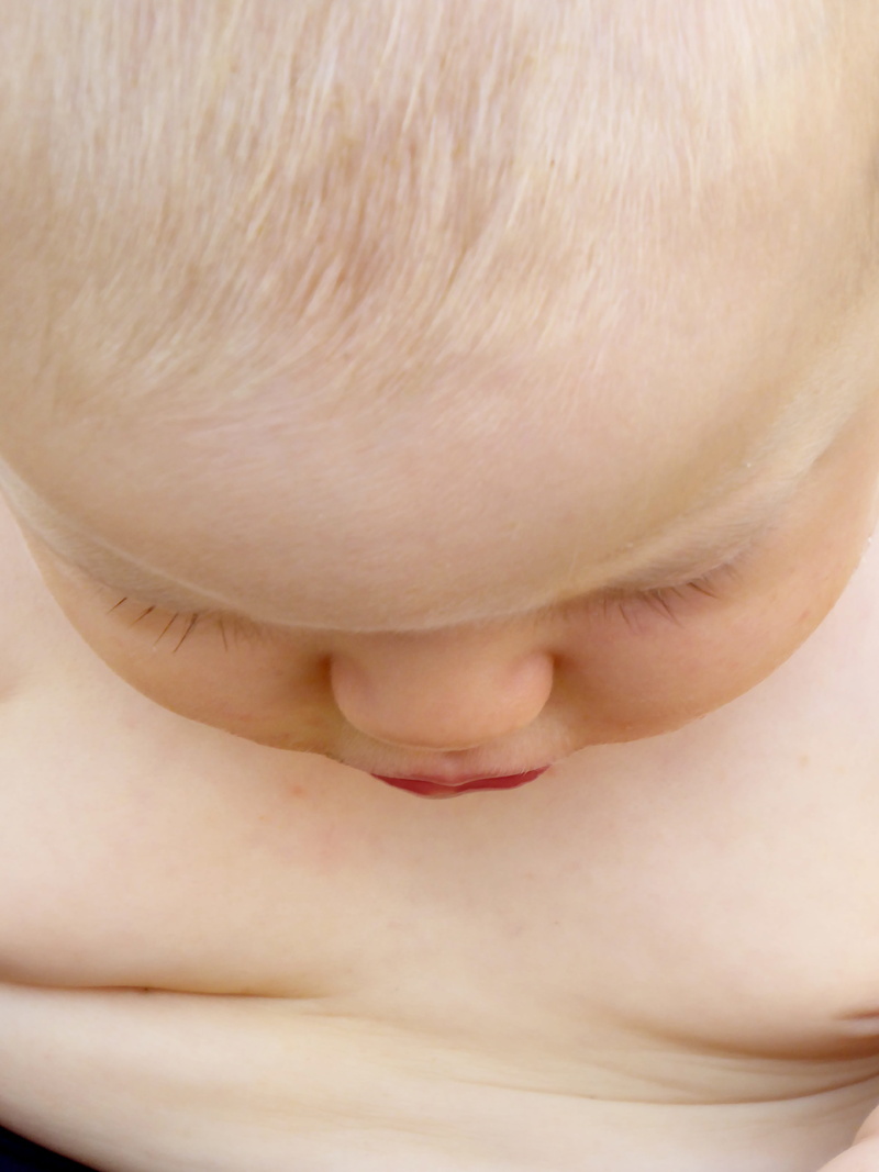 small child, shirtless, innocence, view, young, children only, human body part, examine, hair growth, skin, babyhood, one person, irritation, blond, indoors