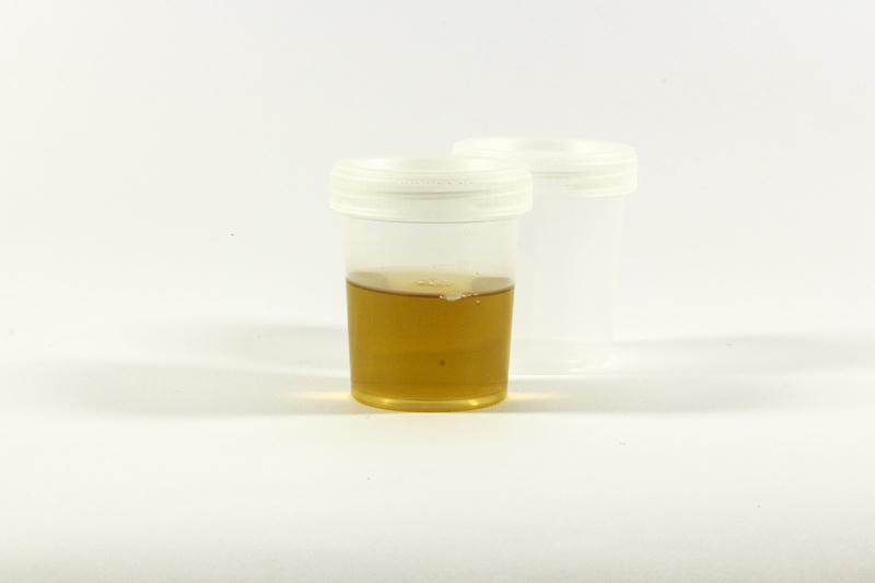 single object, container, bottle, glass - material, hospital, the test, white background, transparent, glass, copy space, small, still life, urine container