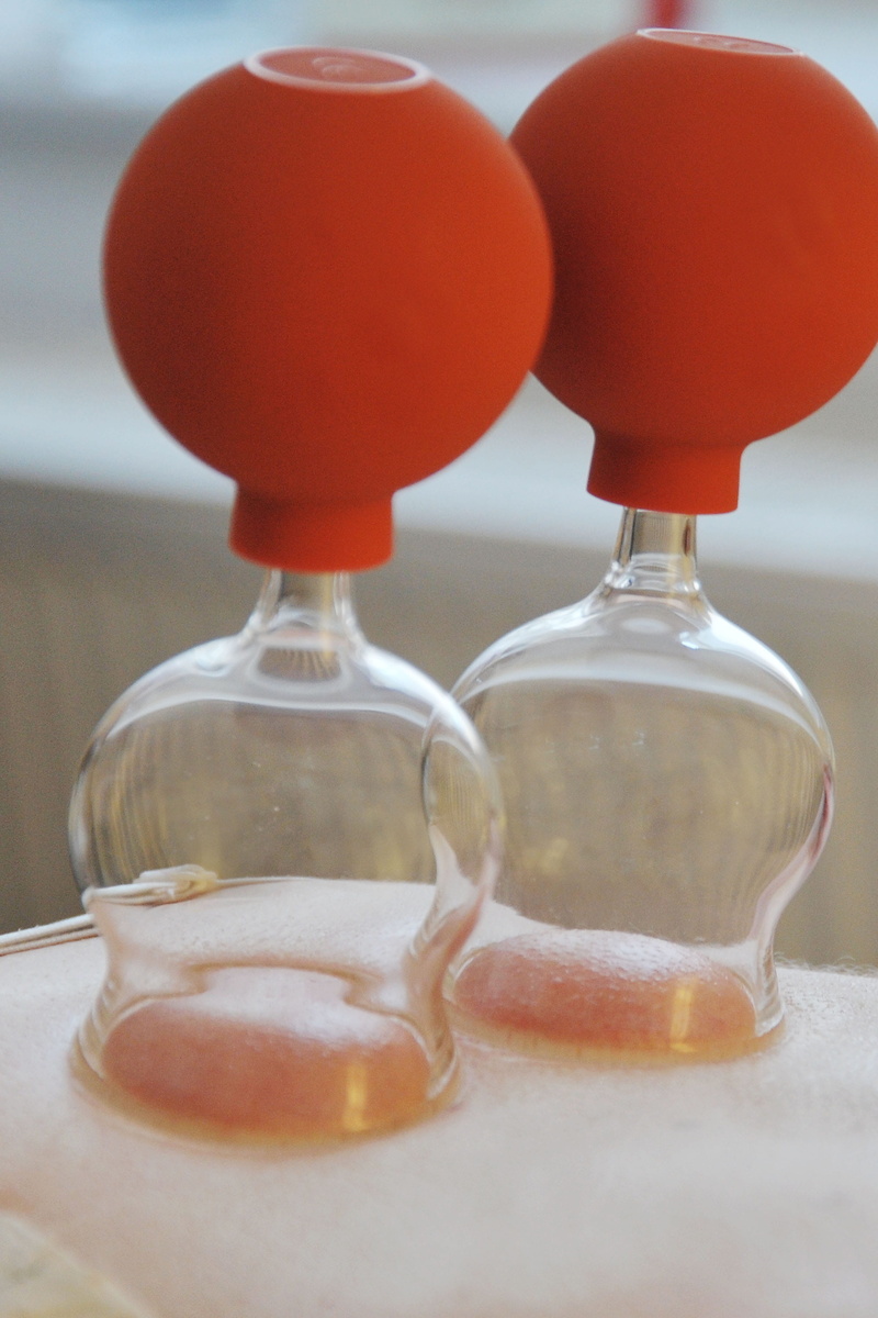 Cupping, food and drink, ventosa, day, cups, transparent, focus on foreground, still life, orange color, cupping glasses, container, Therapy, fragility