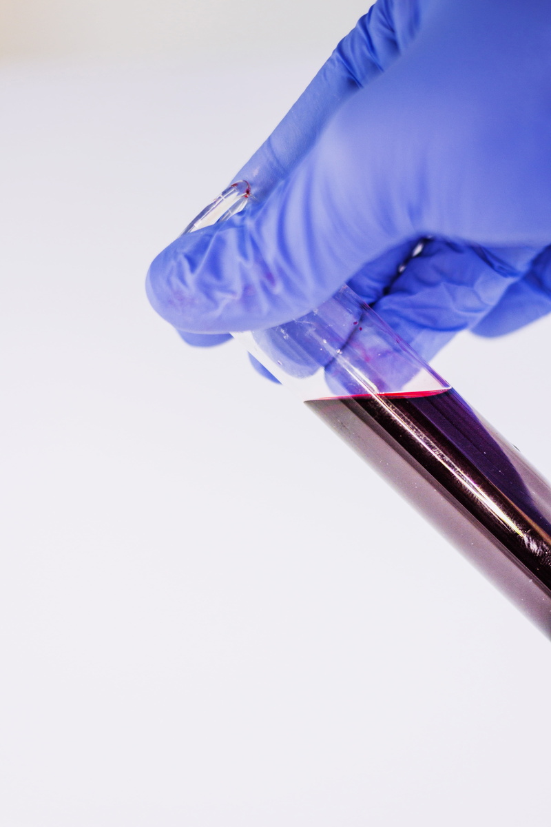 blood, protective glove, protection, sharp, surgical glove, occupation, human hand, healthcare and medicine, attempts, studio shot, hand, human body part