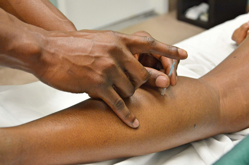 hand, massaging, doctor, adult, healthcare worker, hospital, human limb, recovery, indoors, two people, human arm, human knee, therapy, acupuncture, 4K