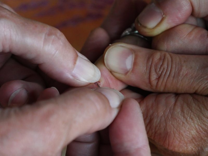 from above, prick, human finger, adult, human foot, hand, operation, positive emotion, first aid personnel, parent, self help, first aid, wound, sting