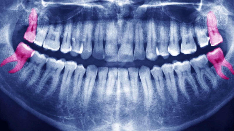 blue, life, human lips, healthcare and medicine, people, science, body part, hygiene, x-ray image, extreme close-up, human face, human mouth, medical x-ray