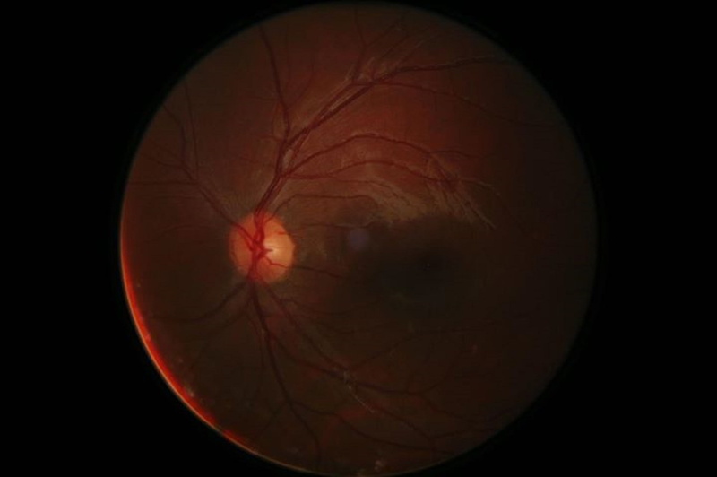 eyesight, human, moon, nerve, black background, circle, space, digital retinal photography, 1080P, biology, retinal, human eye, sensory perception, iris - eye