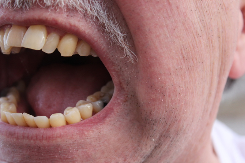 5K, skin, person, mouth open, scream, pain, body conscious, human lips, human face, shout, healthy lifestyle, human mouth, human skin, teenager, angry