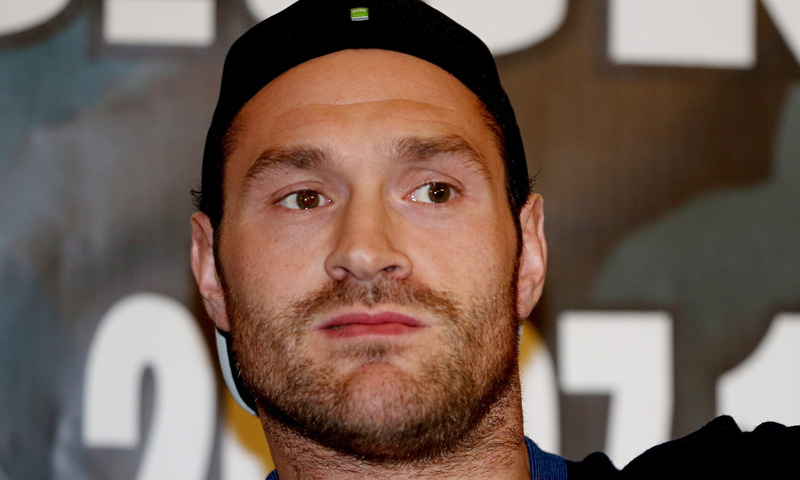 front view, facial hair, headshot, men, young adult, face, close-up, shirt, focus on foreground, adult, young men, mid adult men, s, tyson fury, body part