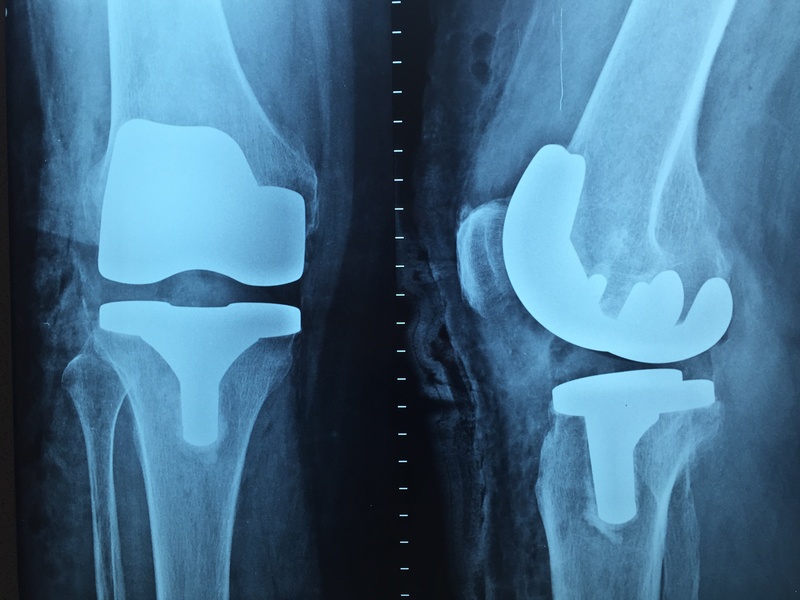 equipment, illuminated, x-ray, result, indoors, doctor, blue background, full frame, body part, x, pattern, ray, 2K, anatomy, blue, metal, x-ray image