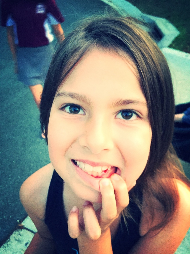 young women, front view, happiness, dental, females, focus on foreground, girl, child, leisure activity, one person, looking at camera, emotion, tooth