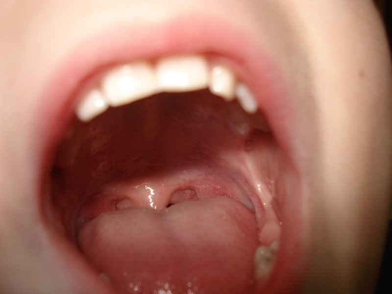 cheek, one person, caucasian, human mouth, Tongue, 2K, physical injury, close-up, body part, red, Head, human teeth, childhood, mouth open, s, human body part