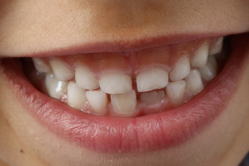dental Health, tooth, extreme close-up, healthcare and medicine, smiling, facial expression, smile teeth, women, human face, 4K, body part, one Person