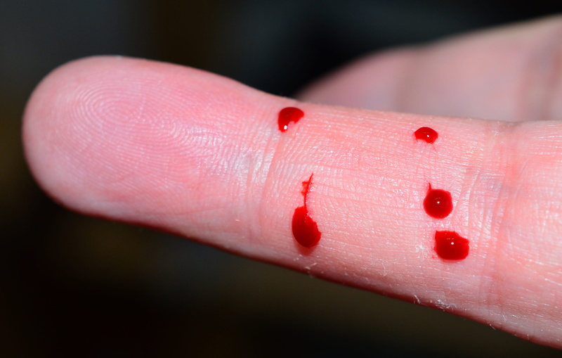 hand, 2K, drops of blood, focus on foreground, pain, healthcare and medicine, red, close-up, blood test, Finger, one person, drop, Red, crime, body part