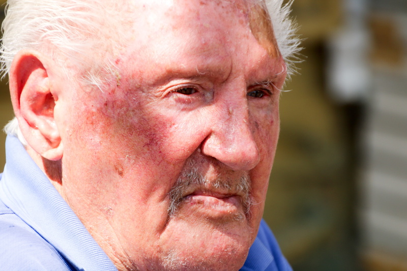 elderly, one person, person, mature men, physical injury, man, aggression, healthcare and medicine, men, blue, male, headshot, old, males, medical condition
