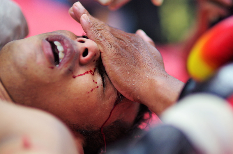 muaythai, accidents and disasters, men, patient, young adult, wound, close-up, athlete, urgency, competition, blood, fight, first aid, physical injury