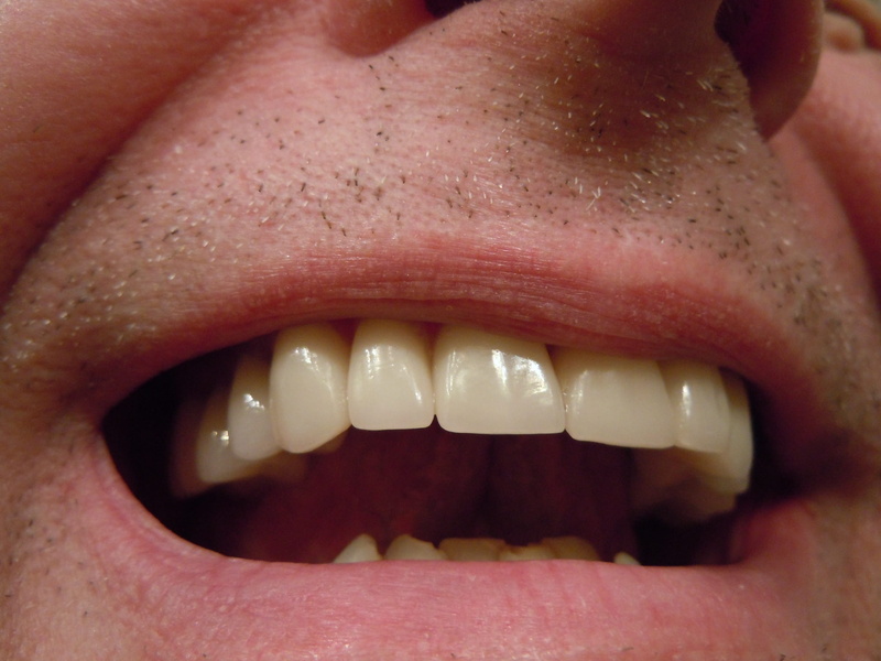 adult, one person, close-up, human mouth, human lips, smiling, s, toothy smile, 2K, human body part, dental health, human teeth, mouth open, human face