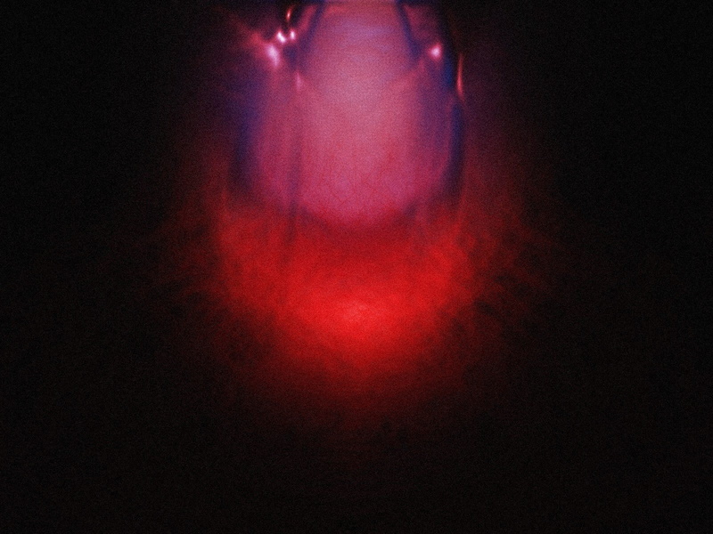 eggs, abstract, 720P, alien, blood