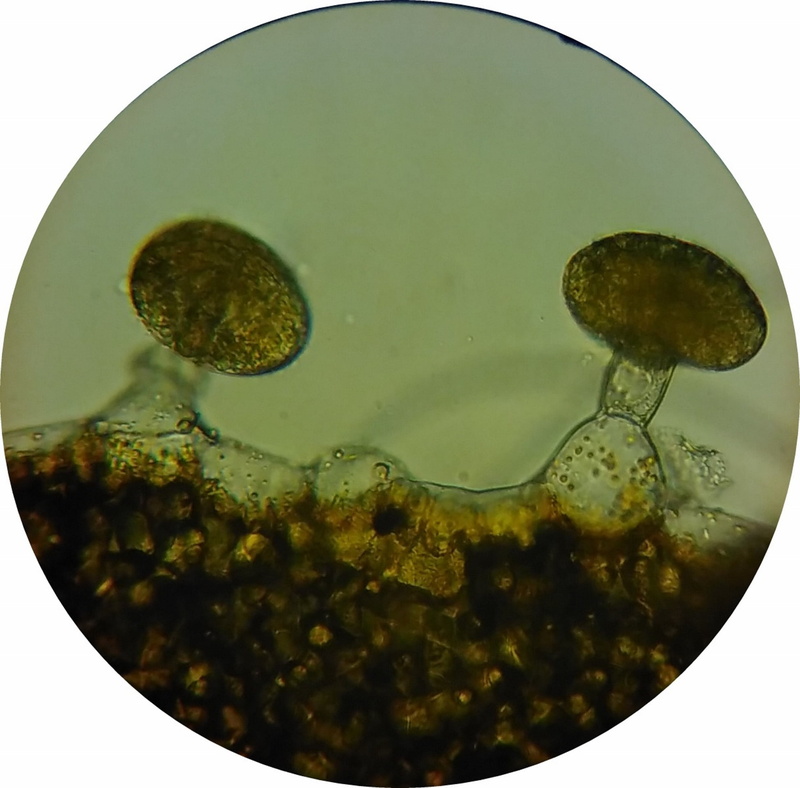 microscope image, indoors, close-up, oil glands, auto post production filter, freshness, no people, water, studio shot, glandular cells, 1080P, bubble