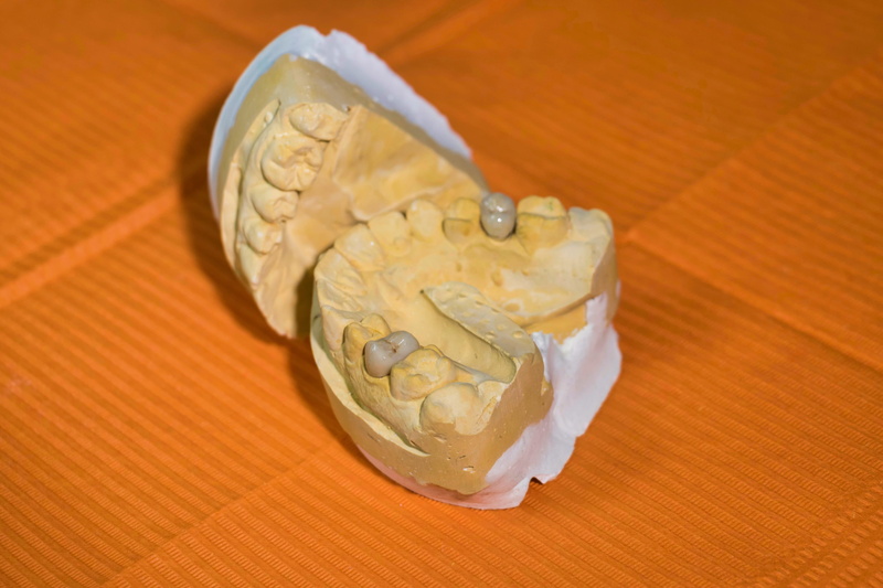 creativity, tooth decay, directly above, wood - material, freshness, 5K, single object, ceramics, molar, business, economy, no people, orange color, high angle view