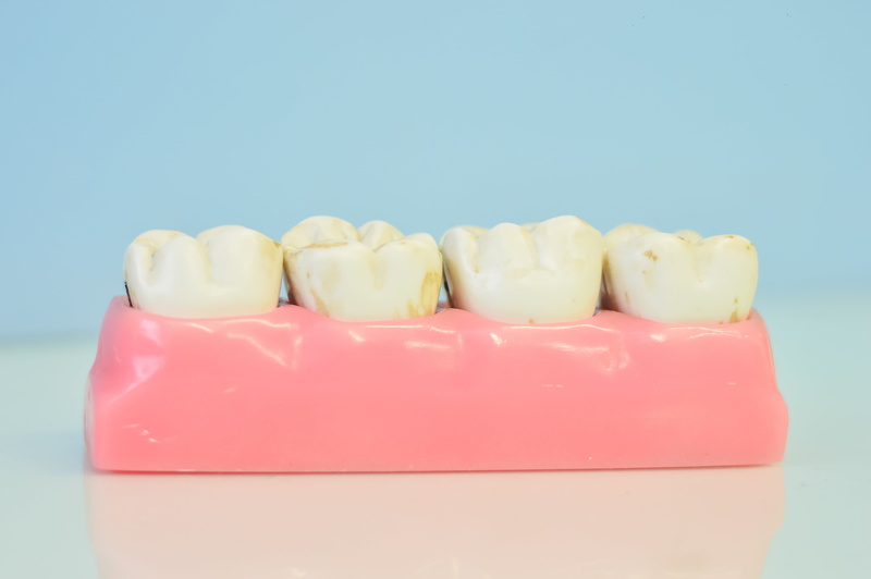 denture, no people, 4K, close-up, dairy product, dental office, in a row, pink color, colored background, indulgence, food and drink, macromodelo of teeth