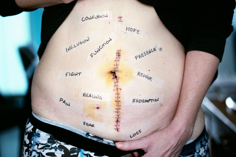 female, finger, hand, healthcare and medicine, western script, text, men, instrument of measurement, survivor, skin, english, midsection, apparel, journey