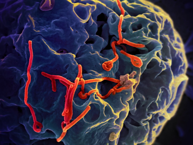 Disease, Ebola, 720P, Medical, horror, Virus, Dark