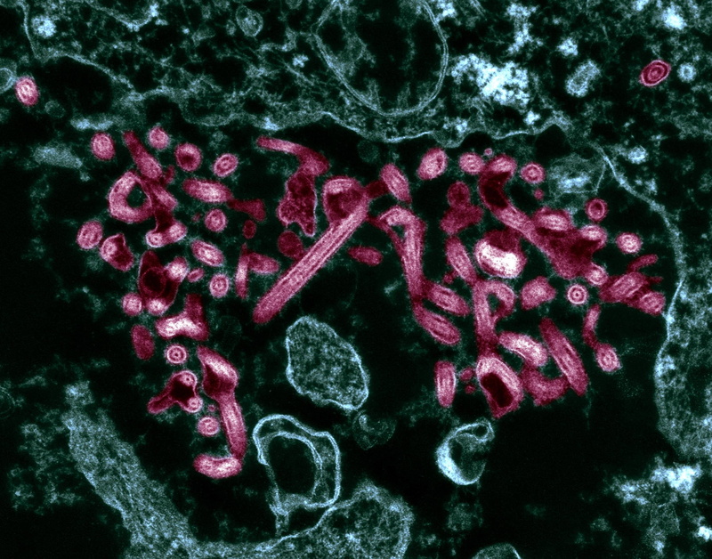 horror, Virus, Medical, 1080P, Ebola, Disease, Dark