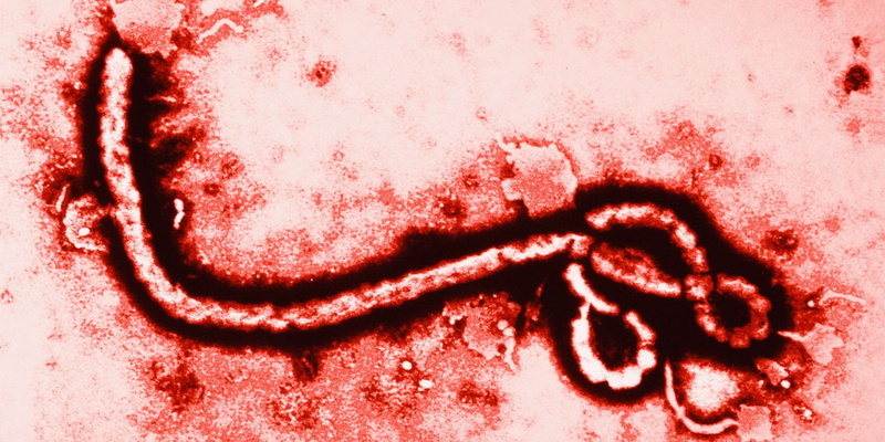 Virus, Medical, Ebola, Disease, 1080P, Dark, horror