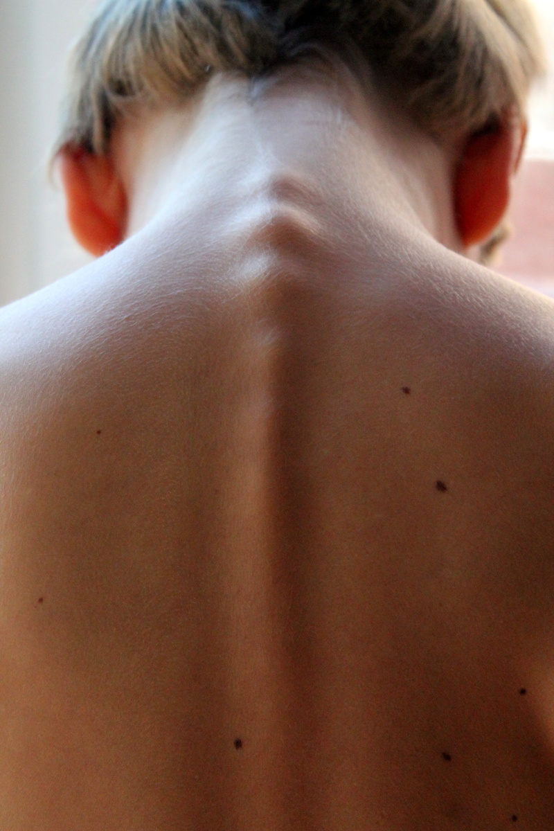 human back, child, woman, human skin, women, rear view, s, spinal column, human face, one person, hairstyle, human body part, skin, real people, backbone