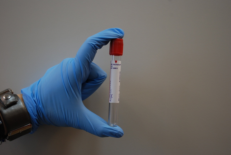 lab, diagnostician, person, diagnostics, human hand, holding, blood, the doctor, indoors, security, hand, one person, human body part, protection, clear