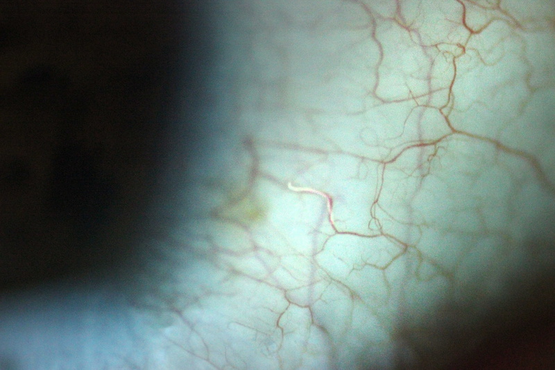 outdoors, pattern, human body part, cornea, vignette, extreme close-up, abstract, abstract backgrounds, selective focus, backgrounds, textured, close-up